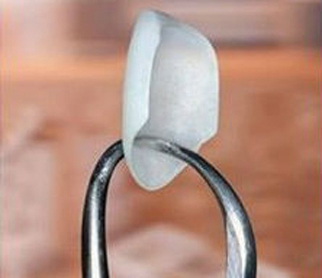 Photo of a single ultra-thin porcelain veneer, like Lumineers, that is held by the tips of dental forceps; for information on the best brands of veneers from Sugar Land dentist Siny Thomas, DMD.