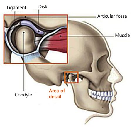 Diagram of the side of a skull with details of the TMJ magnified in the forefront and labeled, including ligament and disk (upper), the condyle beneath them, and the muscle attached to the side of the joint.