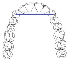 diagram of teeth with support line illustration