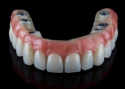 An upper denture manufactured to accomodate six dental implants, for info on All on 4 implants in Sugar Land, TX