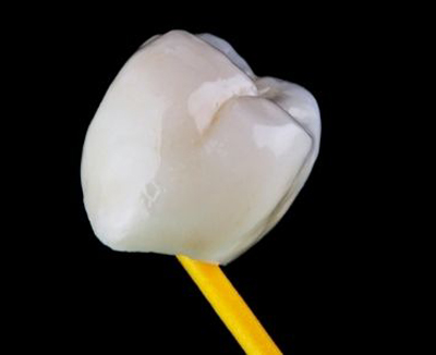 A dental crown for a molar tooth