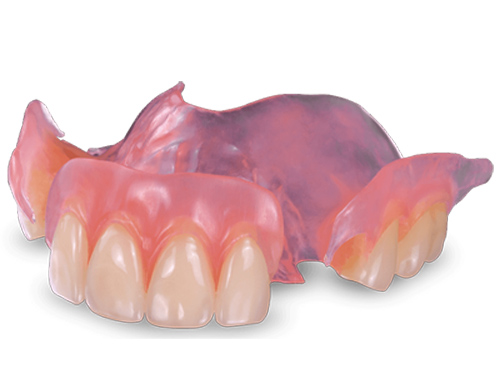 A flexible metal-free partial denture
